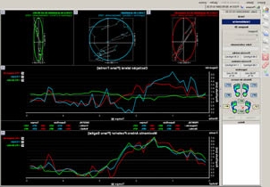 huella plantar por medico podologo
